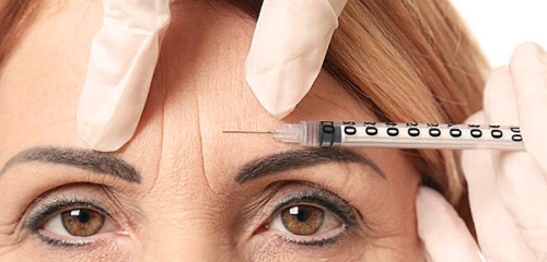 Injeccions de botox a les celles: matisos importants