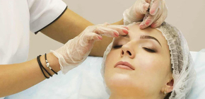 Wat is belangrijk om te weten over Botox-injecties