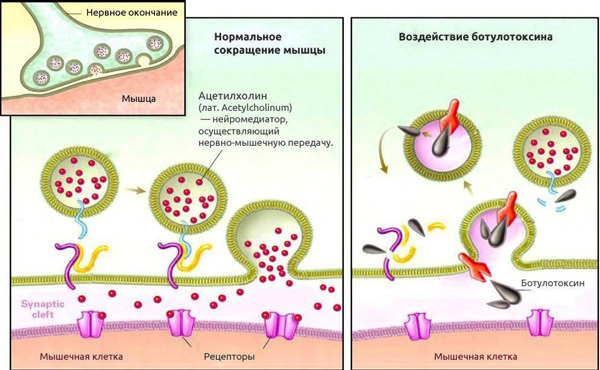 Action musculaire de la toxine botulique