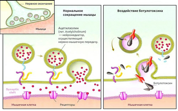 Comment la toxine botulique affecte les cellules musculaires