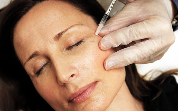 Placement correct des aiguilles pour les injections de Botox