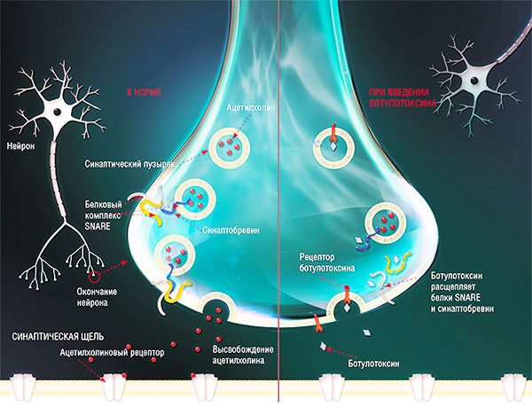 L'effet de la toxine botulique sur une cellule nerveuse